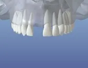Missing Teeth