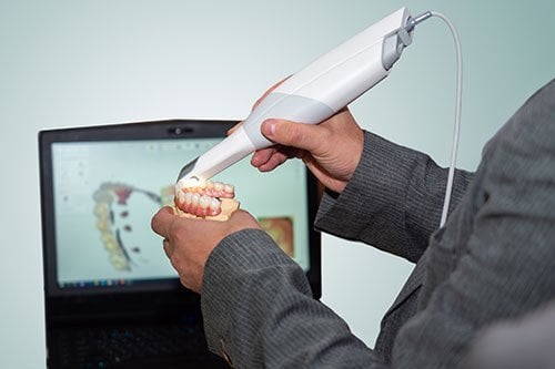 iTero IntraOral Scanner